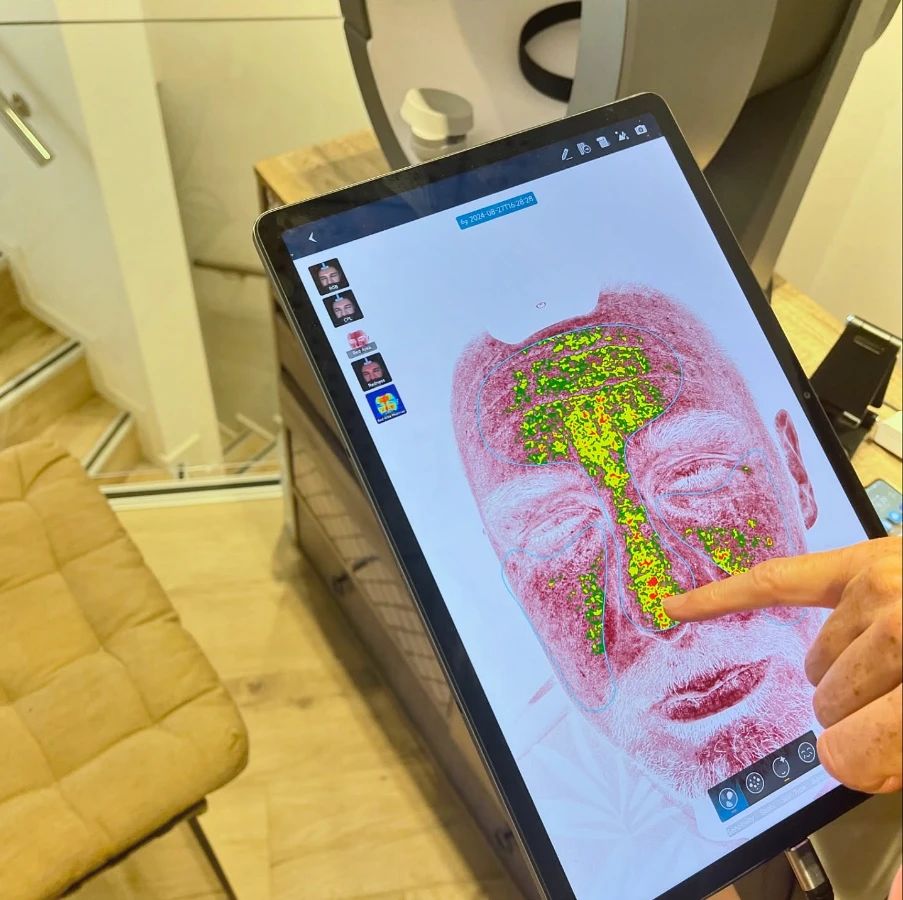 Diagnostic de peau affiché sur tablette lors d'un bilan à l'institut